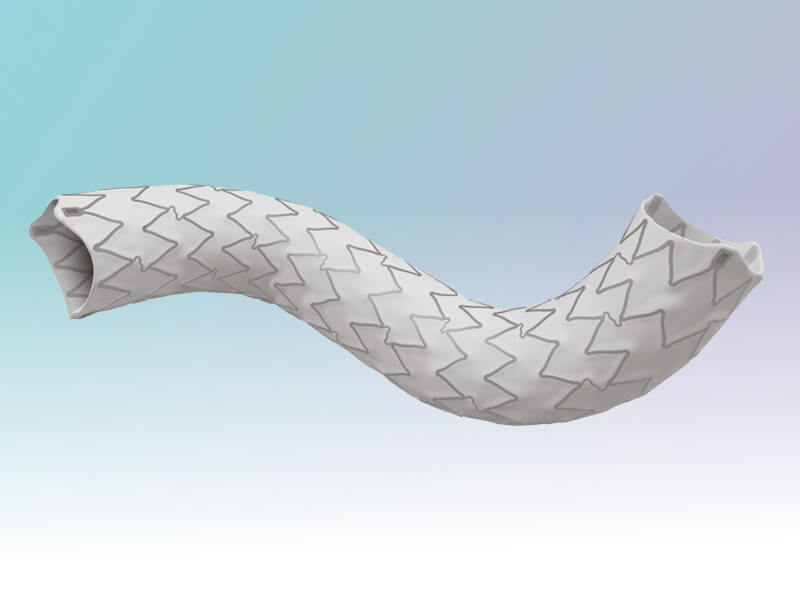 The Role of Covered Stents in Treating Iliac Disease